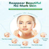 Loshall Scar Removal Peel Mask - Wolrdiscounts