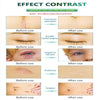 Loshall Scar Removal Peel Mask - Wolrdiscounts