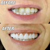 The Amazing Perfect Smile - Wolrdiscounts