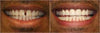 The Amazing Perfect Smile - Wolrdiscounts